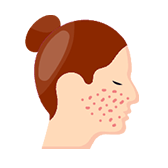 Calming & Controlling Acne, Rashes and Outbreaks